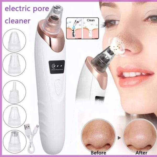 A person using an electric vacuum blackhead remover on their nose, showing clear results and glowing skin after deep pore cleansing.